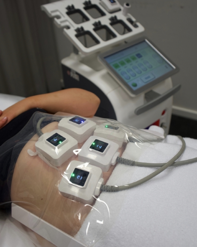 Body Contouring truSculpt