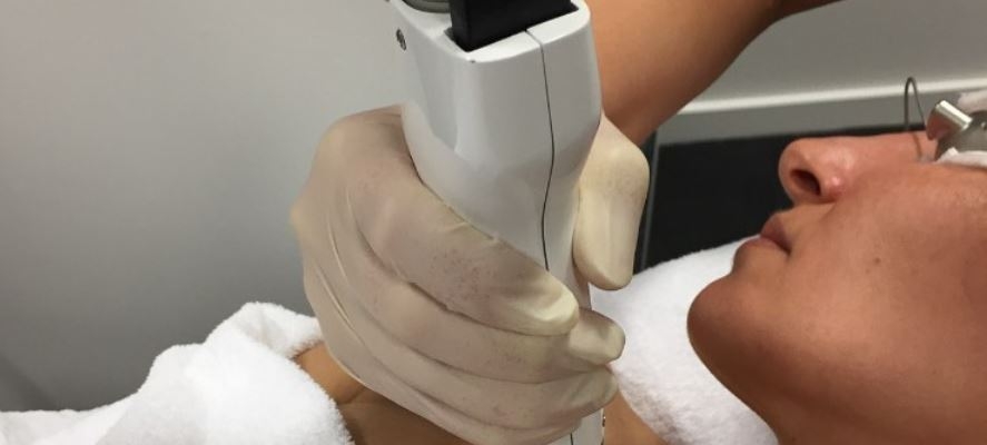 PICO Pigmentation Treatment